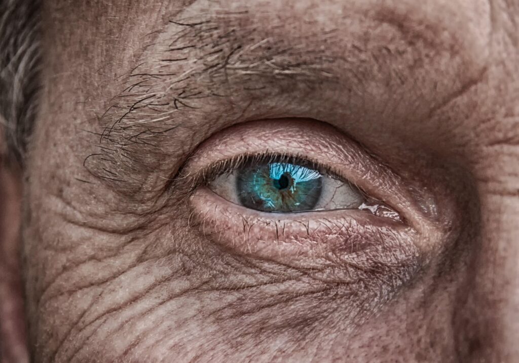 手の甲の若返りに最適な美容医療とは？